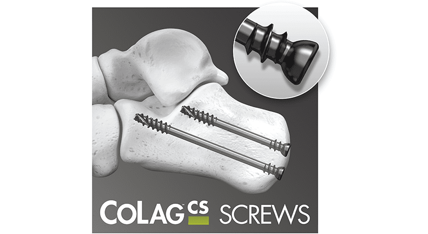 In2Bones CoLag Screws