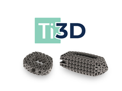 HT Medical Ti3D Interbody Cages - ORTHOWORLD