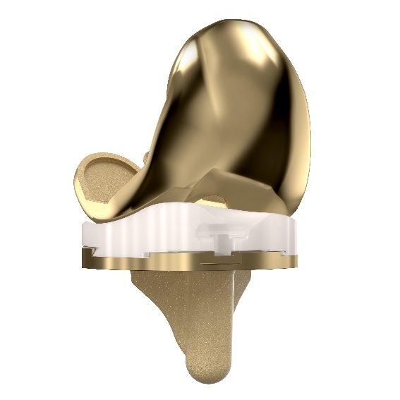 MicroPort Orthopedics Evolution NitrX Medial-Pivot Knee - ORTHOFLASH