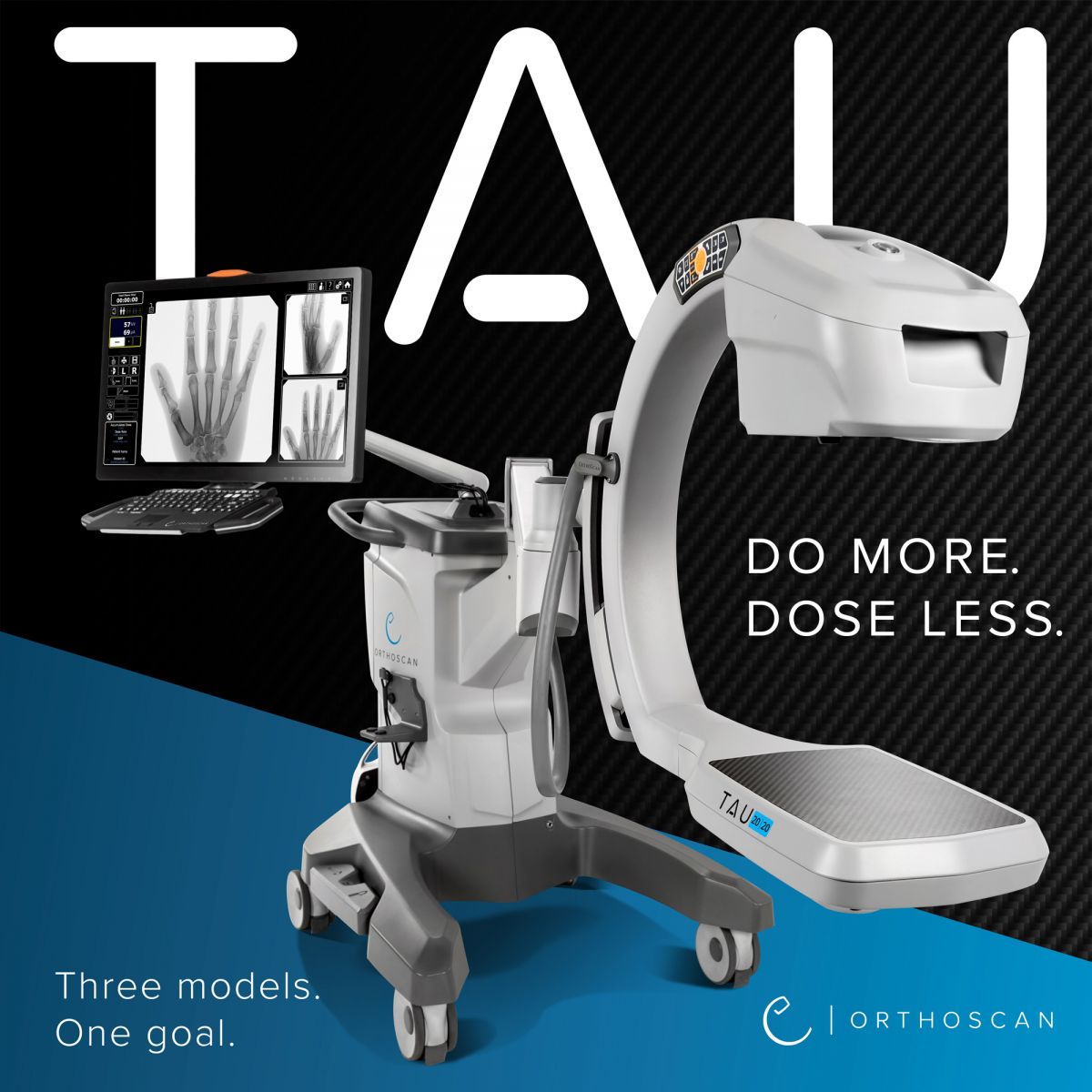 Orthoscan TAU Mini C-Arm - ORTHOWORLD