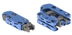 Innovasive DualX Expanding Interbody - ORTHOFLASH