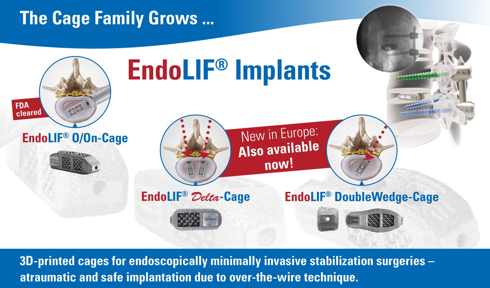 joimax EndoLIF Implants - ORTHOFLASH