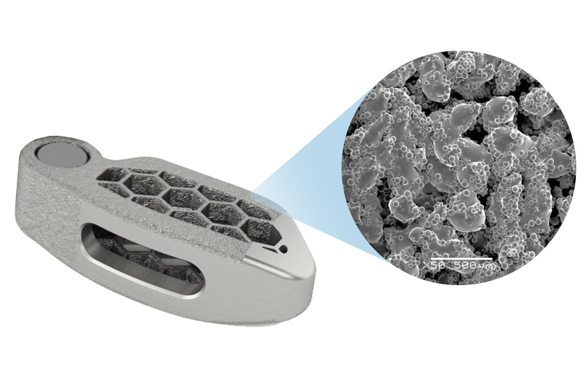 Medtronic ARTiC-L TiONIC Spinal System