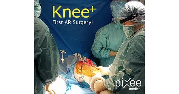 Vuzix and Pixee Knee Procedure