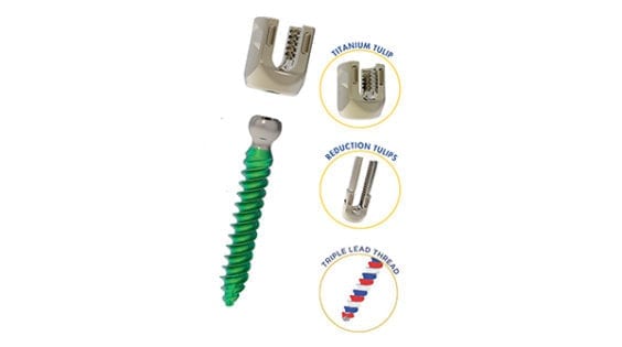 Precision Spine Reform Ti Modular Screw