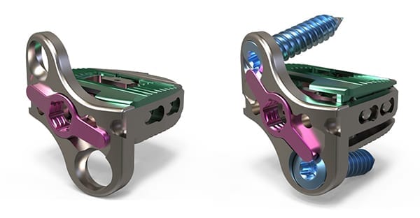Atlas Spine HiJAK SA Expandable
