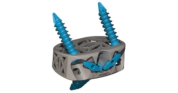 4WEB Stand-alone Anterior Spine Truss