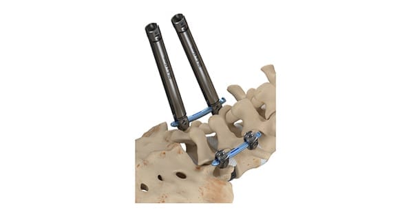 ATEC Spine InVictus Fixation Platform