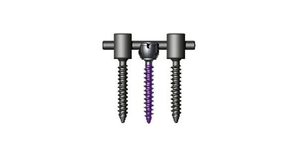 Stryker MESA Degenerative Spine System