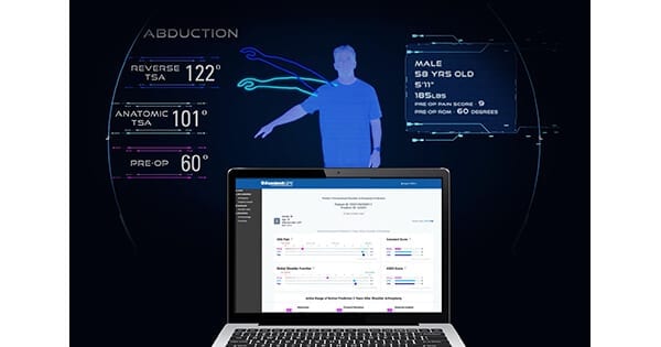 Exactech Predict+ Machine Learning