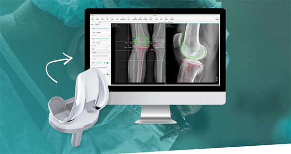 GO Ortho Agreement with PeekMed