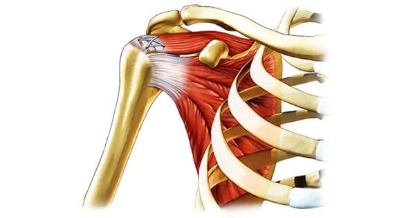 Ortho RTI Rotator Cuff Repair