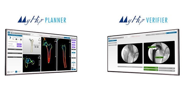 Medacta MyHip Tools