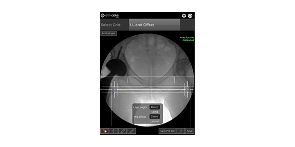 OrthoGrid Hip Software