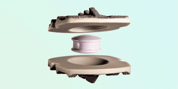 Simplify Medical's artificial cervical disc