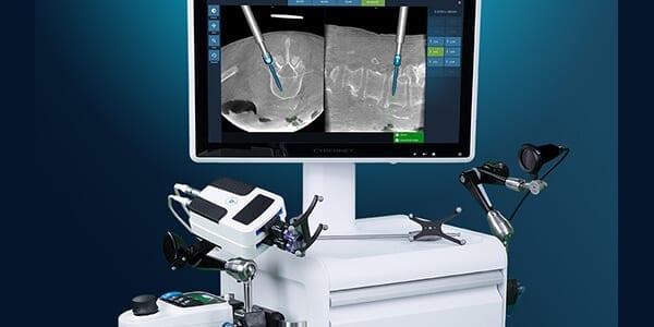 Fusion Robotics Navigation and Robotic Targeting