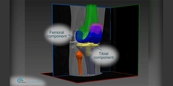 RSIP Vision Segmentation Tool