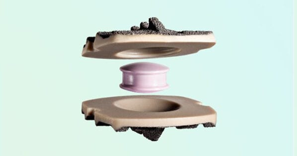 3-level Cervical Disc Replacement Fda Approved Simplify Disc Gains Approval for 2-Level Cervical Disc Replacement