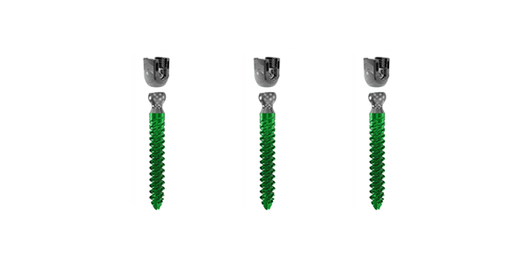 Precision Spine Reform Modular Pedicle Screw