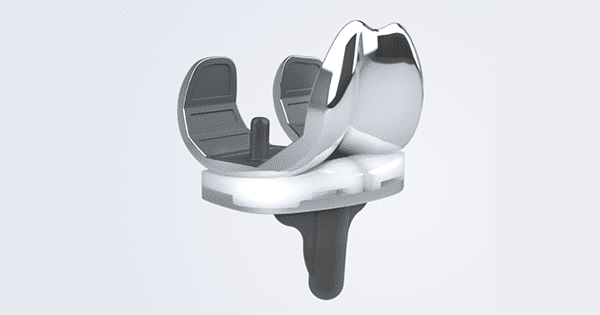 Conformis iTotal CR Knee