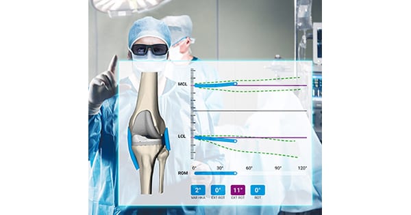 Medacta NextAR Augmented Reality