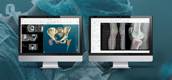 PeekMed Surgical Planning