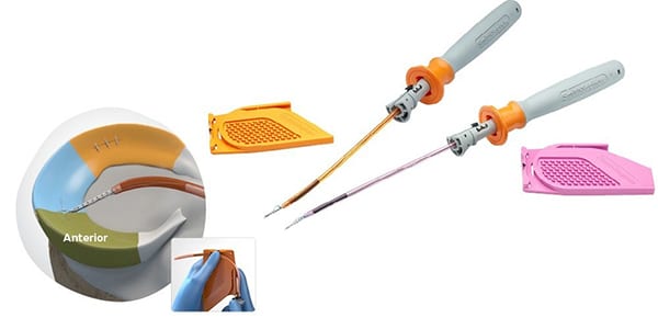 Smith+Nephew FAST FIX Meniscal Repair