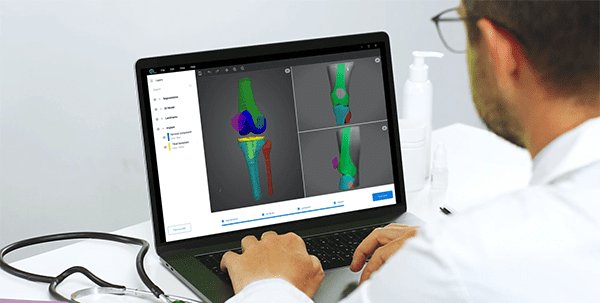 RSIP Vision Surgical Planning