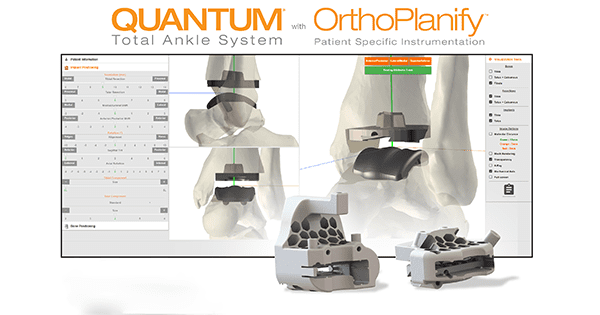 In2Bones Quantum OrthoPlanify