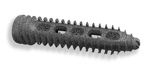 ChoiceSpine Triton Screw