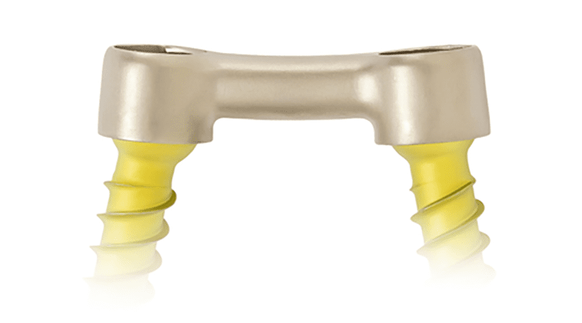 Nexus Spine PressON Posterior Lumbar Fixation