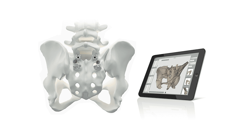 Medacta MySpine Anchor