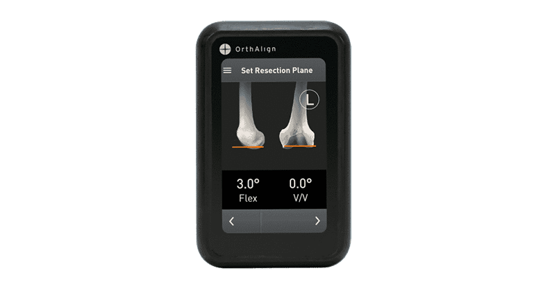 OrthAlign Lantern Handheld Surgical Navigation