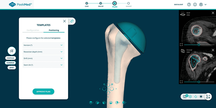 PeekMed Automated Orthopedic Solution