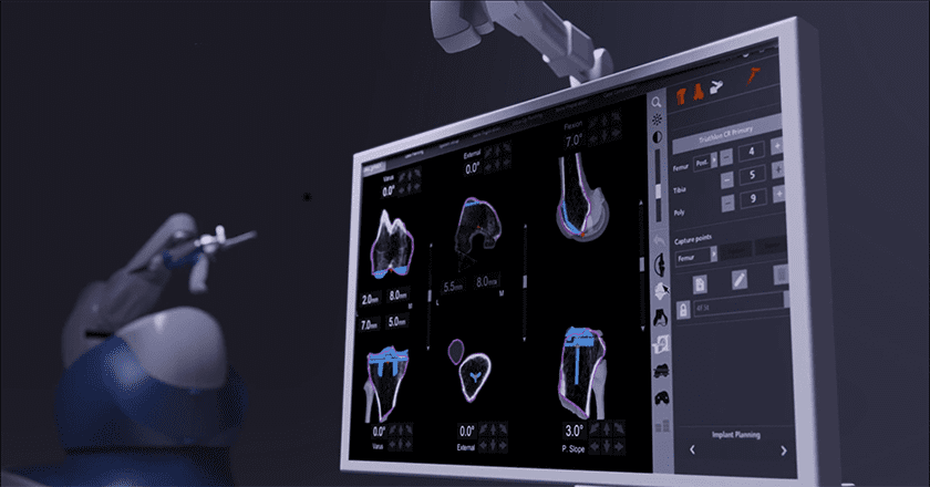 Stryker Mako Total Knee 2.0