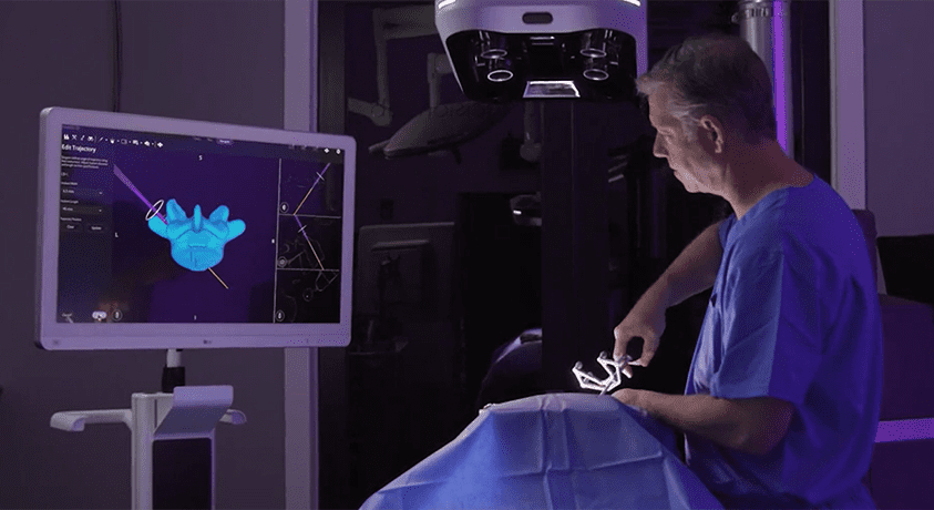 Proprio Paradigm Surgery Navigation Platform