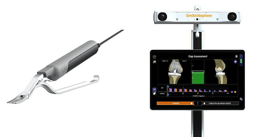 Smith+Nephew CORI Tensioner