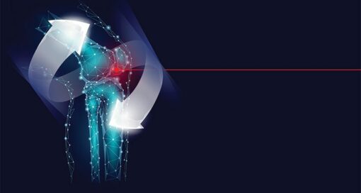 The grant will help complete pre-clinical development and testing of a synthetic total meniscus replacement in preparation for the clinic.