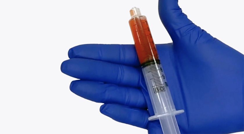 Isto Biologics PRECISE Autologous Therapy
