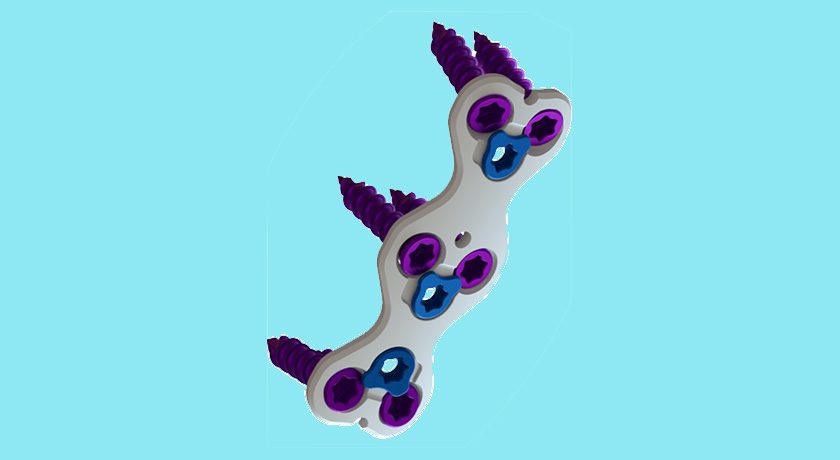MiRus CYGNUS MoRe Anterior Cervical Plate