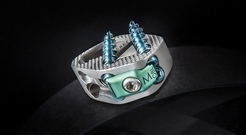 NovApproach OneLIF Spinal Fusion