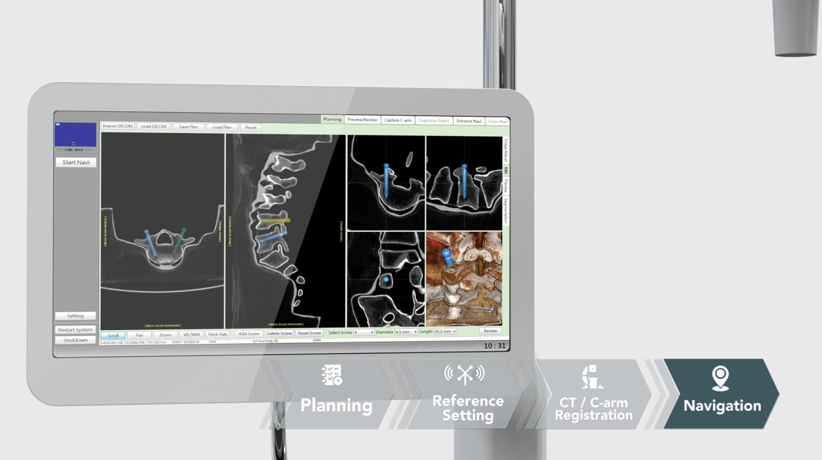 Captiva Spine Navigation Image Guidance