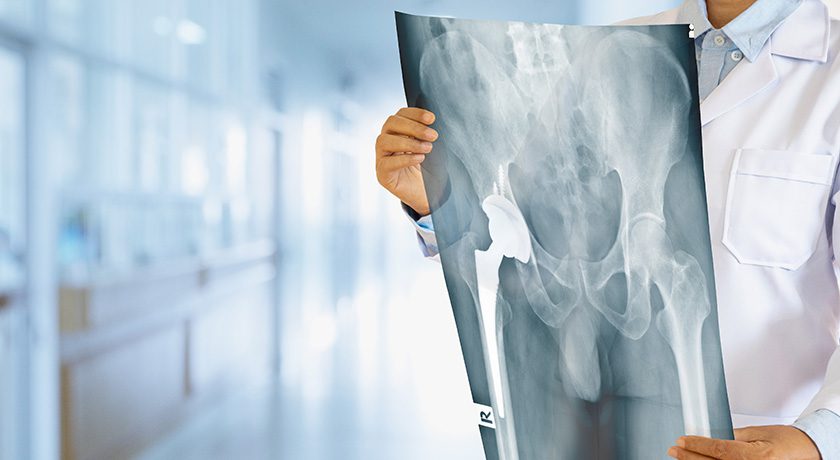 Stay up to date on the orthopedic market's 1Q performance in 2024 as we update this post with company sales data and industry developments.