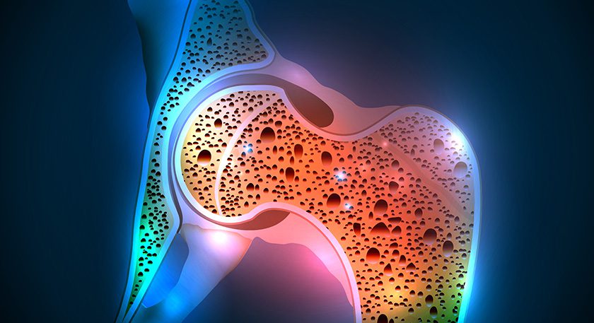 16 Bit offers Rho, AI-enabled software aimed at improving a known care gap in osteoporosis screening.