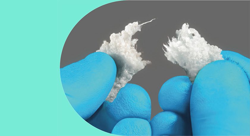 Biogennix Agilon Moldable Bone Graft