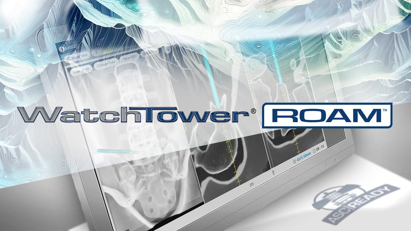 Captiva Spine WatchTower ROAM Spine Navigation