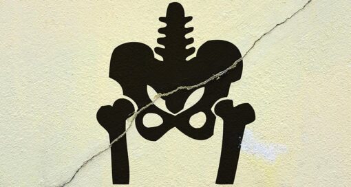 A look at the current state of the foot and ankle market, the growth of core trauma and ways that smaller players are leveraging niche subsegments.