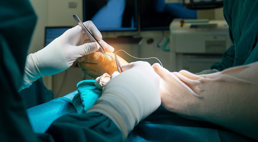 Foot surgery