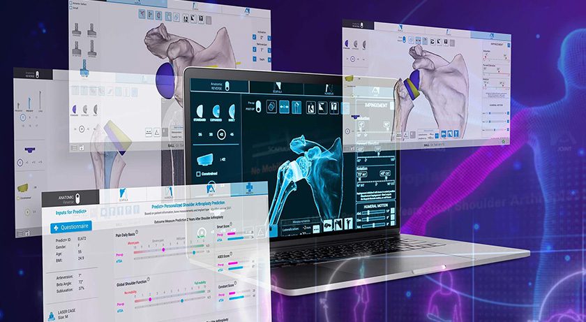 Exactech Shoulder Planning App