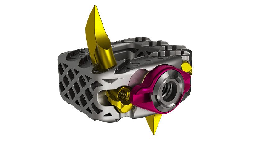 Genesys Spine Launches Stasys-C 3DP Cervical Standalone System